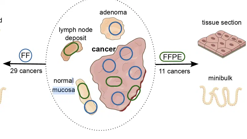 Epigenome and early selection determine the tumour-immune evolutionary trajectory of colorectal cancer