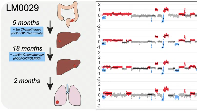 Negative Selection Maintains Grossly Altered but Broadly Stable Karyotypes in Metastatic Colorectal Cancer
